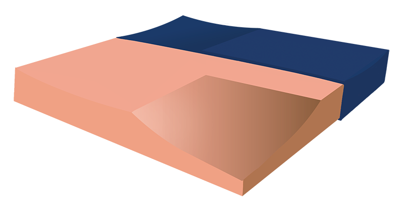 Produktbild Arthroseat