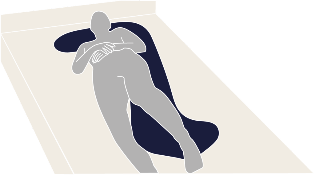 Illustration des Positionierungsbeispiels mit dem Full Body Positionierungskissen